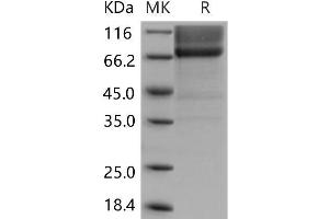 Western Blotting (WB) image for Biglycan (BGN) protein (Fc Tag) (ABIN7320153) (Biglycan Protein (BGN) (Fc Tag))