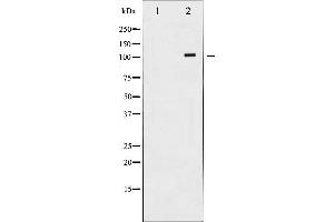 Western blot analysis of PDGFR beta expression in H2O2 treated LOVO whole cell lysates,The lane on the left is treated with the antigen-specific peptide. (PDGFRB antibody  (C-Term))