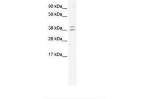 Image no. 1 for anti-Tumor Susceptibility Gene 101 (TSG101) (AA 164-213) antibody (ABIN202411) (TSG101 antibody  (AA 164-213))