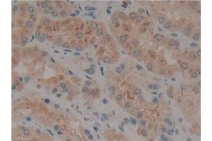 Immunohistochemistry (IHC) image for anti-Fms-Related tyrosine Kinase 3 (FLT3) (AA 334-543) antibody (ABIN7430516)