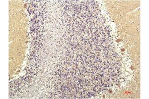 Immunohistochemical analysis of paraffin-embedded Human Brain Tissue using SGK1 Mouse mAb diluted at 1:200. (SGK1 antibody  (AA 350-430))