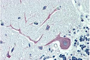 ABIN185115 (5µg/ml) staining of paraffin embedded Human Cerebellum. (OSBPL1A antibody  (C-Term))