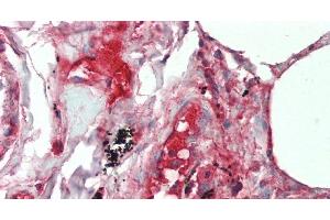 Immunohistochemistry of paraffin-embedded Lung tissue using IL19 Polyclonal Antibody at dilution of 1:90 . (IL-19 antibody)