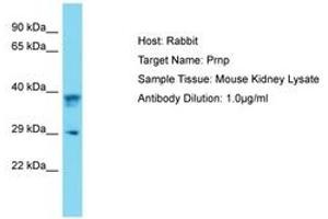 Image no. 1 for anti-Prion Protein (PRNP) (AA 91-140) antibody (ABIN6750495) (PRNP antibody  (AA 91-140))