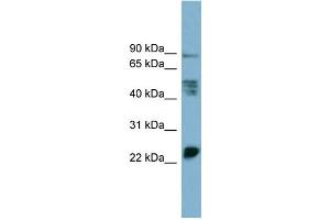 WB Suggested Anti-MPZL1  Antibody Titration: 0. (MPZL1 antibody  (Middle Region))