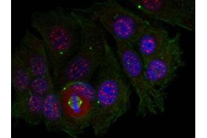 Image no. 1 for anti-Myocyte Enhancer Factor 2A (MEF2A) (pThr319) antibody (ABIN401542) (MEF2A antibody  (pThr319))