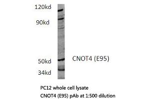 Western blot (WB) analysis of CNOT4 antibody in extracts from PC12 cells.