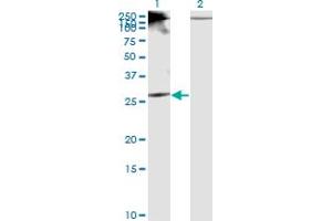Western Blot analysis of RICTOR expression in transfected 293T cell line by RICTOR monoclonal antibody (M01), clone 1F3.
