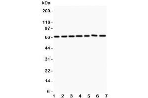 Western blot testing of ANG1 antibody and Lane 1:  HeLa;  2: MCF-7;  3: COLO320;  4: A549;  5: HEPG2;  6: 293T;  7: SW620. (Angiopoietin 1 antibody  (AA 16-350))