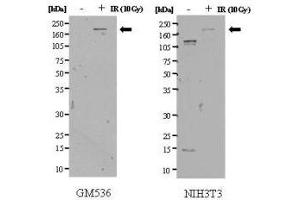 Anti-SMC1 pS957 Antibody - Western Blot. (SMC1B antibody  (pSer957))