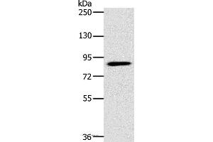 Western blot analysis of 293T cell, using PLEKHG6 Polyclonal Antibody at dilution of 1:400 (PLEKHG6 antibody)