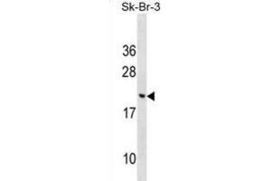 Western Blotting (WB) image for anti-Cornichon Homolog 3 (CNIH3) antibody (ABIN2999518) (CNIH3 antibody)