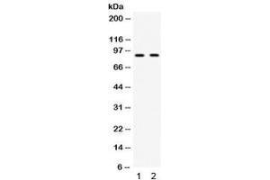 Western blot testing of 1) mouse testis and 2) human HeLa lysate with CIP2A antibody.