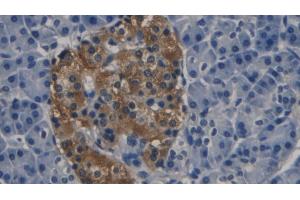 Detection of PCT in Human Pancreas Tissue using Monoclonal Antibody to Procalcitonin (PCT) (Procalcitonin antibody  (AA 26-141))