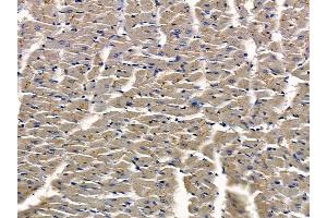 ABIN7094258 and ABIN7098305 at 1/100 staining rat heart tissue by IHC-P.
