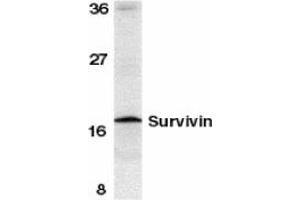 Image no. 1 for anti-Baculoviral IAP Repeat-Containing 5 (BIRC5) (C-Term) antibody (ABIN204355) (Survivin antibody  (C-Term))