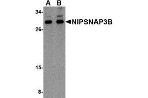 Western Blotting (WB) image for anti-Nipsnap Homolog 3B (NIPSNAP3B) (Middle Region) antibody (ABIN1031018) (NIPSNAP3B antibody  (Middle Region))