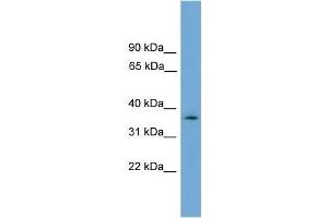 Human U937; WB Suggested Anti-NUBP1 Antibody Titration: 0. (NUBP1 antibody  (N-Term))