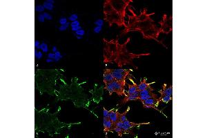 Immunocytochemistry/Immunofluorescence analysis using Mouse Anti-Alpha B Crystallin Monoclonal Antibody, Clone 1A7. (CRYAB antibody  (Atto 390))