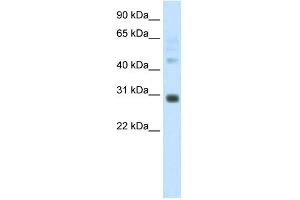WB Suggested Anti-DLX5 Antibody Titration:  1. (DLX5 antibody  (C-Term))