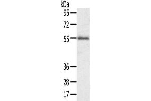 Gel: 8 % SDS-PAGE,Lysate: 40 μg,Primary antibody: ABIN7192490(SLC43A2 Antibody) at dilution 1/200 dilution,Secondary antibody: Goat anti rabbit IgG at 1/8000 dilution,Exposure time: 1 minute (SLC43A2 antibody)