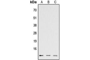 Western blot analysis of CCL26 expression in HEK293T (A), Raw264. (CCL26 antibody  (Center))