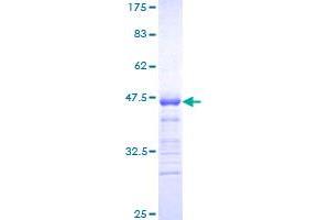 CDKN1B Protein (AA 99-198) (GST tag)