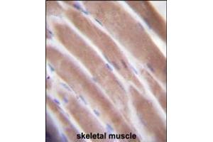 VEGF3 Antibody immunohistochemistry analysis in formalin fixed and paraffin embedded human skeletal muscle followed by peroxidase conjugation of the secondary antibody and DAB staining. (VEGFC antibody  (N-Term))
