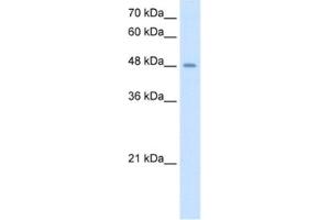 Western Blotting (WB) image for anti-Transmembrane Protease, serine 11D (TMPRSS11D) antibody (ABIN2462980)