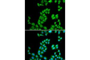 Immunofluorescence analysis of MCF-7 cell using RNASE13 antibody. (RNASE13 antibody)