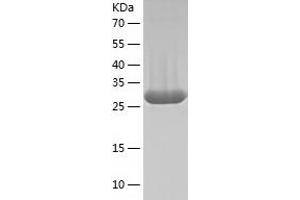 Western Blotting (WB) image for Purine Nucleoside Phosphorylase (PNP) (AA 1-289) protein (His-IF2DI Tag) (ABIN7124229)
