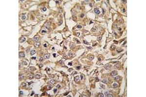 Immunohistochemistry (IHC) image for anti-Myosin Light Chain Kinase 3 (MYLK3) (AA 40-69) antibody (ABIN3031919)