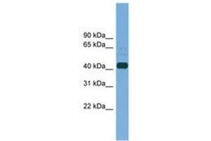 Image no. 1 for anti-Plasminogen Activator, Tissue (PLAT) (AA 323-372) antibody (ABIN6745203) (PLAT antibody  (AA 323-372))