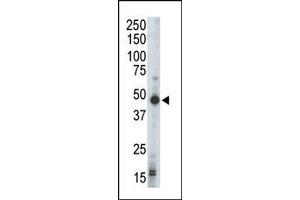 Image no. 1 for anti-Protein Kinase, CAMP-Dependent, Regulatory, Type I, beta (PRKAR1B) (N-Term) antibody (ABIN359120)