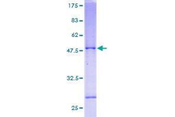 Selenoprotein S Protein (SELS) (AA 1-189) (GST tag)