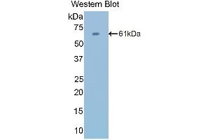 Western Blotting (WB) image for anti-Catalase (CAT) (AA 10-507) antibody (ABIN1858264) (Catalase antibody  (AA 10-507))