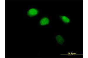 Immunofluorescence of purified MaxPab antibody to ZBTB12 on HeLa cell.