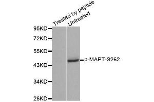 Western blot analysis of extracts from mouse brain tissue using Phospho-MAPT-S262 antibody (ABIN2988151).