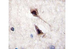 Immunohistochemistry (IHC) image for anti-Myocyte Enhancer Factor 2C (MEF2C) (AA 365-394) antibody (ABIN3031902)