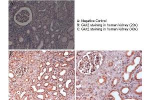 Immunohistochemistry with anti-Glut2 antibody showing Glut2 staining in nucleus and cytoplasm of ductal epithelium and of renal glomeruli in human kidney at 20x and 40x (B & C).