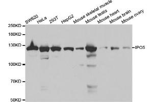 Western blot analysis of extracts of various cell lines, using IPO5 antibody (ABIN5971032) at 1/1000 dilution. (Importin 5 antibody)