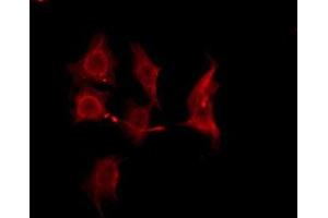 ABIN6276129 staining HeLa by IF/ICC. (OR2B8P antibody)