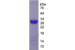 SDS-PAGE analysis of Mouse CYP2E1 Protein. (CYP2E1 Protein)