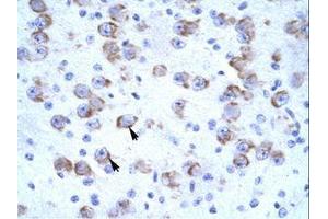 Image no. 1 for anti-Cation Channel, Sperm Associated 2 (CATSPER2) (AA 31-80) antibody (ABIN203121) (CATSPER2 antibody  (AA 31-80))