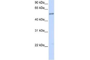 IL1RL1 antibody used at 1 ug/ml to detect target protein. (IL1RL1 antibody  (N-Term))