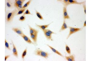 Immunohistochemistry (IHC) image for anti-BCL2-Antagonist/killer 1 (BAK1) (AA 22-211) antibody (ABIN3042342)