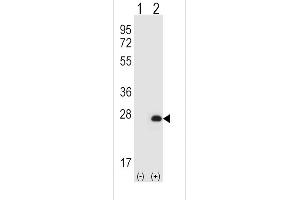Western blot analysis of HPRT1 using rabbit polyclonal HPRT1 Antibody using 293 cell lysates (2 ug/lane) either nontransfected (Lane 1) or transiently transfected (Lane 2) with the HPRT1 gene. (HPRT1 antibody  (N-Term))