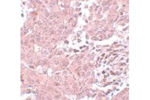 Immunohistochemistry (IHC) image for anti-Breast Carcinoma Amplified Sequence 3 (BCAS3) (N-Term) antibody (ABIN1031263) (BCAS3 antibody  (N-Term))