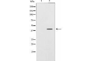 Western blot analysis on SK-OV3 cell lysate using NRG1 isoform-10 Antibody,The lane on the left is treated with the antigen-specific peptide. (Neuregulin 1 antibody  (N-Term))