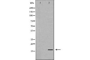 Western blot analysis of extracts of HeLa  using H3K79me2 antibody. (Histone 3 antibody  (H3K79me2))